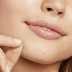 Acne Dots