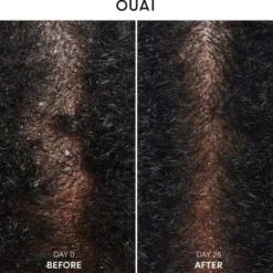 Anti-Dandruff Shampoo