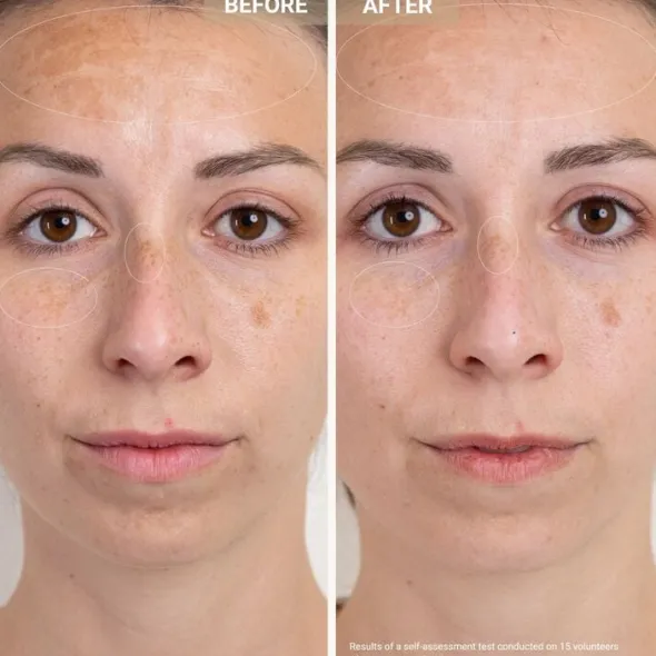 Anti-Redness Clarifying Care - Serum mot rodnad och orenheter