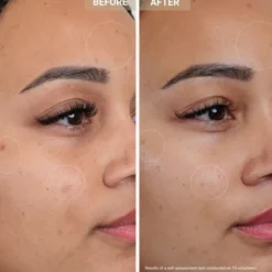 Anti-Redness Clarifying Care - Serum mot rodnad och orenheter