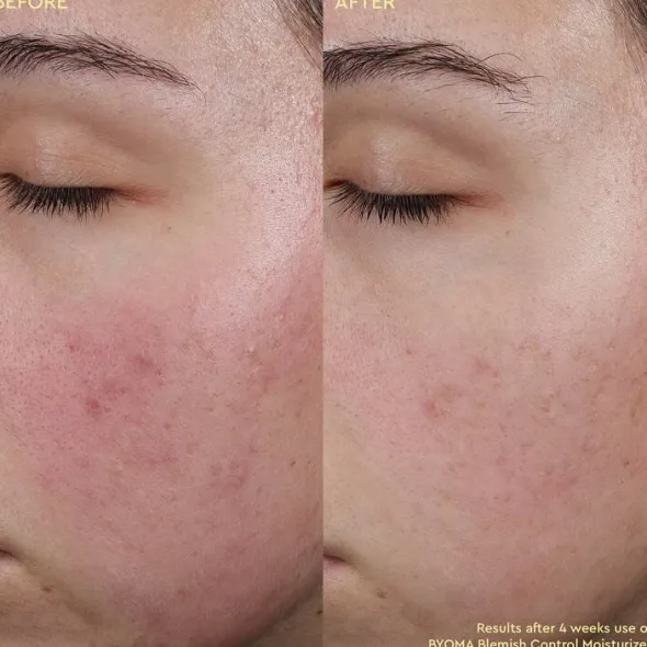 Blemish Control Moisturizer - Fuktkräm som motverkar ojämnheter