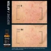 Clinical Home Peel Dark Spot 50 ml