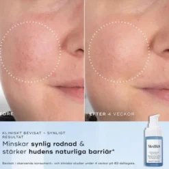 Niacinamide Peptides