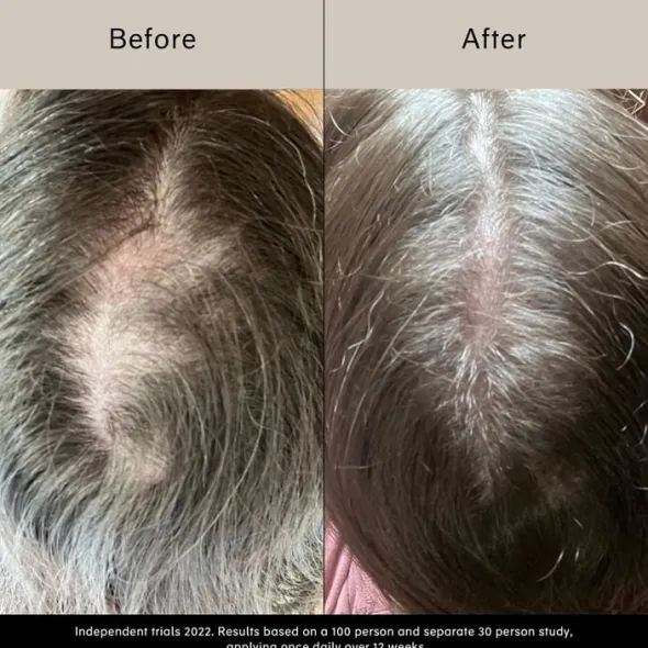 Pitta Growth Serum - Tillväxtserum