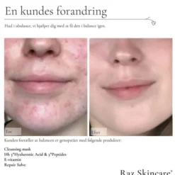 Raz Skincare Cleansing Mask 200 g