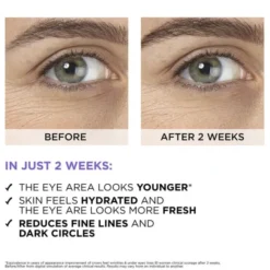 Revitalift Filler 2. 5% Hyaluronic Acid+Caffeine Eye Serum 20ml