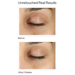 Vita-C Eyes Dark Circle Corrector