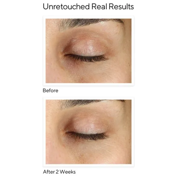 Vita-C Eyes Dark Circle Corrector